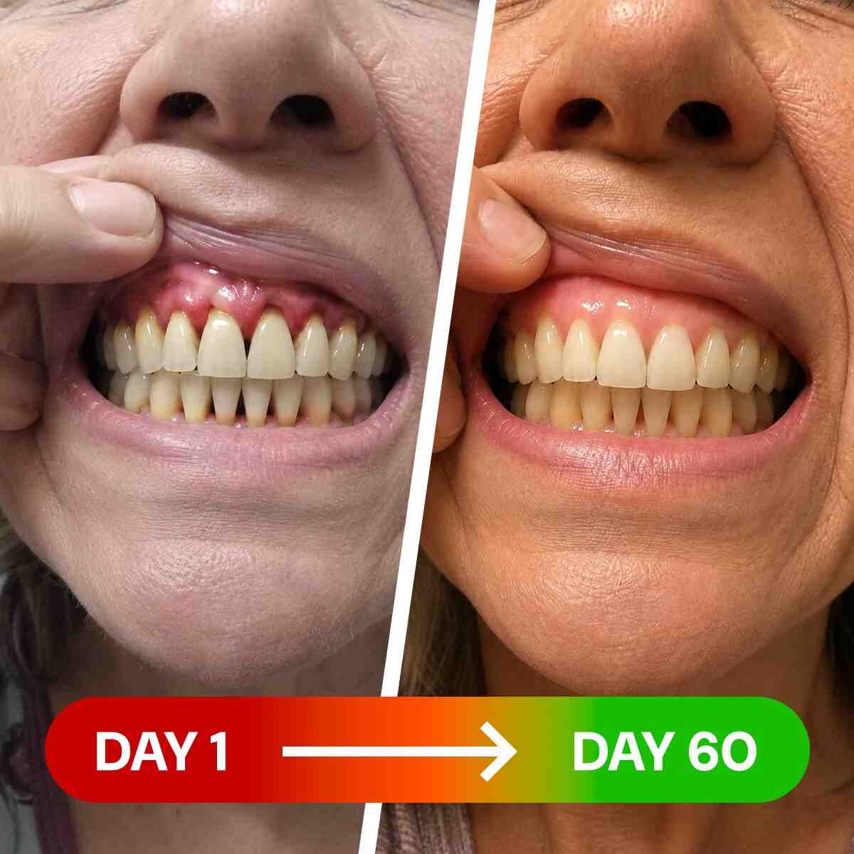 Toothcare Red LightResults